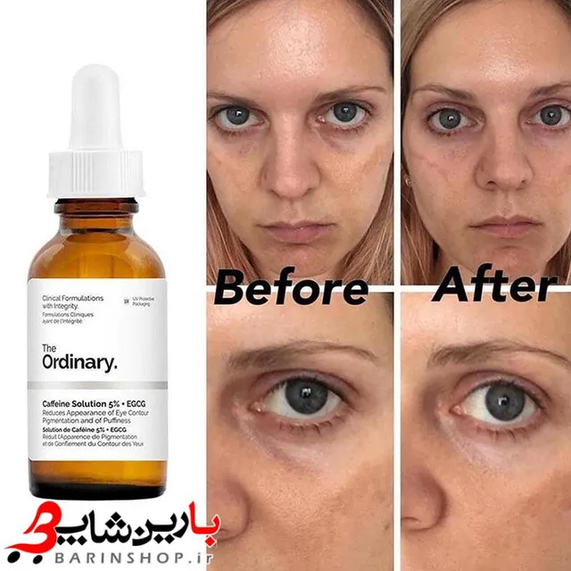 سرم دور چشم ضد تیرگی و پف کافئین اوردینری - تصویر 4