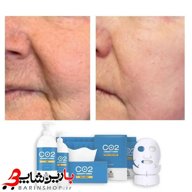 ژل کربوکسی ریب اسکین 1500 میلی لیتر - تصویر 4