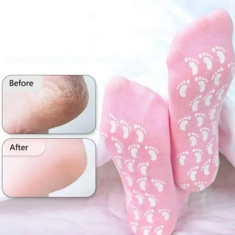 جوراب سیلیکونی ترک پا Spa Gel Socks