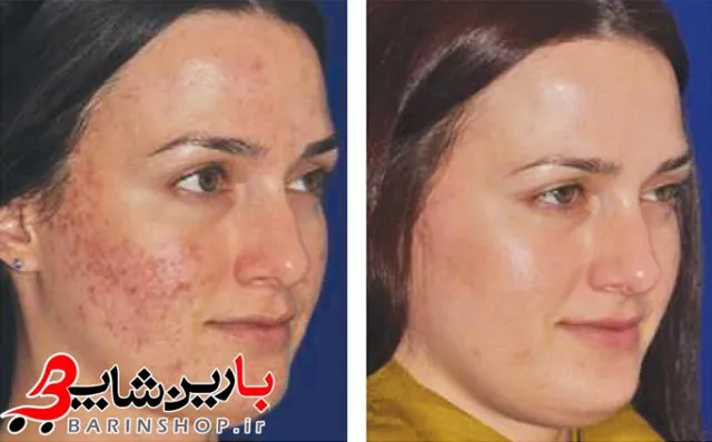 کوکتل ضد لک و روشن کننده ژنوسیس SWS - تصویر 4