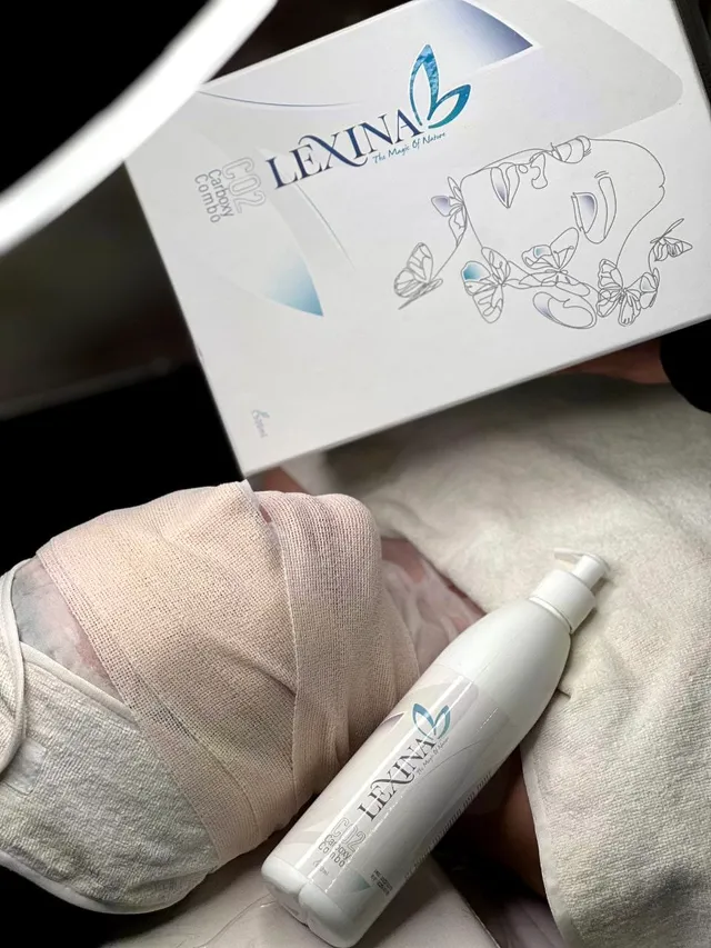 پک کربوکسی تراپی لکسینا Lexina - تصویر 6