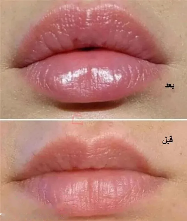 حجم دهنده لب کاریته حاوی روغن آرگان - تصویر 5