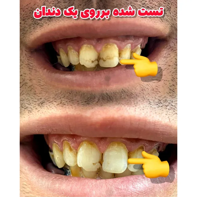 جرمگیر و سفید کننده دندان لاورا (LAVERA) - تصویر 2