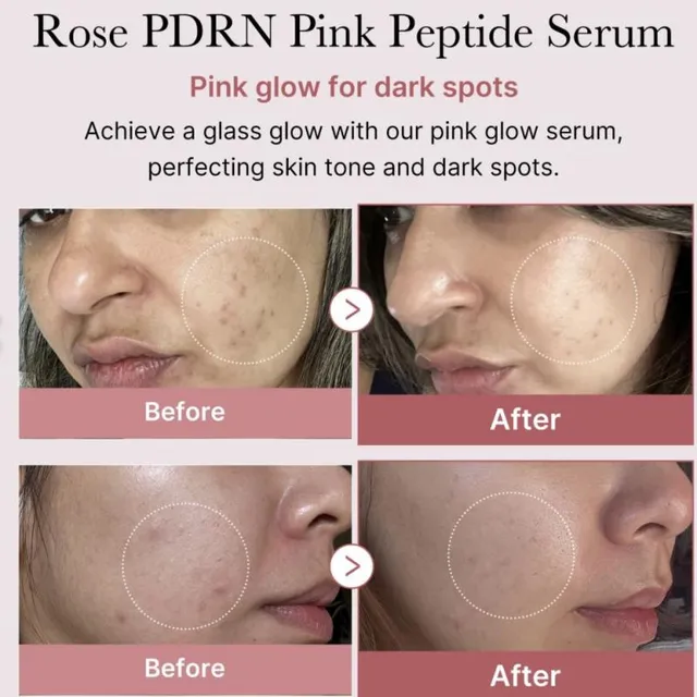 سرم صورتی مدی‌کیوب PDRN Medicube - تصویر 3